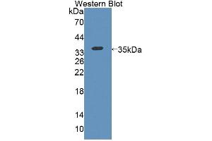 Image no. 2 for anti-Kell Blood Group, Metallo-Endopeptidase (KEL) (AA 439-713) antibody (ABIN5013824)