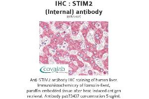 Image no. 1 for anti-Stromal Interaction Molecule 2 (Stim2) (Internal Region) antibody (ABIN1739718)