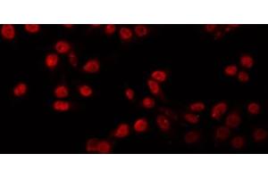 Image no. 4 for anti-Protein Inhibitor of Activated STAT, 1 (PIAS1) (N-Term) antibody (ABIN6264195)