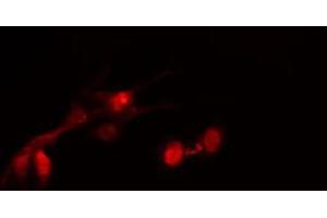 Image no. 1 for anti-Histone Deacetylase 2 (HDAC2) (pSer394) antibody (ABIN6256313)