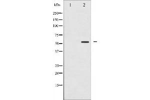 Image no. 2 for anti-Peroxisome Proliferator-Activated Receptor gamma (PPARG) (pSer112) antibody (ABIN6256109)