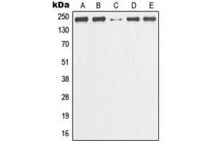 Image no. 2 for anti-Minichromosome Maintenance Complex Component 3 Associated Protein (MCM3AP) (C-Term) antibody (ABIN2704826)