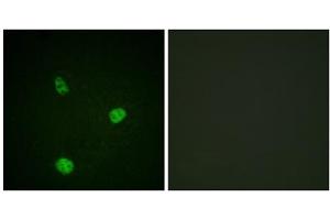 Image no. 1 for anti-Microphthalmia-Associated Transcription Factor (MITF) (Ser180), (Ser73) antibody (ABIN1847958)