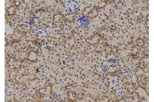 Image no. 2 for anti-RPTOR Independent Companion of mTOR, Complex 2 (RICTOR) (pSer1591) antibody (ABIN6270234)