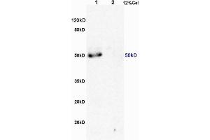 Image no. 1 for anti-Macrophage Scavenger Receptor 1 (MSR1) (AA 211-320) antibody (ABIN872905)