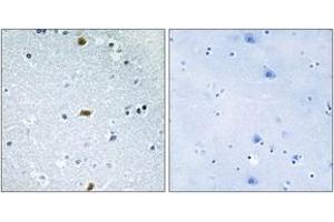 Image no. 1 for anti-Zinc Finger Homeobox 3 (ZFHX3) (AA 761-810) antibody (ABIN1533928)