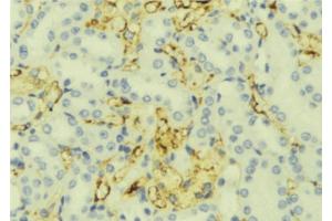Image no. 1 for anti-Retinitis Pigmentosa GTPase Regulator (RPGR) antibody (ABIN6264824)