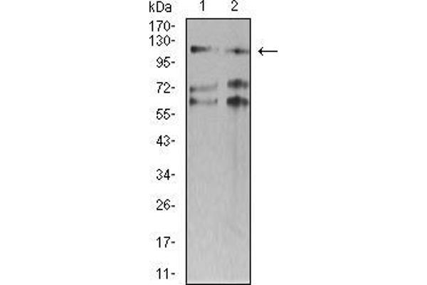 anti-SWI/SNF Related, Matrix Associated, Actin Dependent Regulator of Chromatin, Subfamily A, Member 1 (SMARCA1) (AA 933-1070) antibody