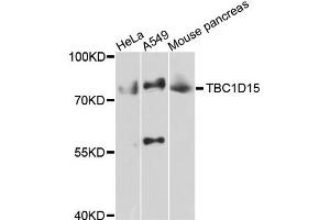 Image no. 1 for anti-TBC1 Domain Family, Member 15 (TBC1D15) antibody (ABIN4905372)