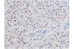 Image no. 4 for anti-Signal Transducer and Activator of Transcription 1, 91kDa (STAT1) (pSer727) antibody (ABIN6256410)