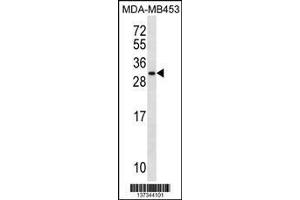 Image no. 1 for anti-Mitochondrial Ribosomal Protein S10 (MRPS10) (AA 113-141) antibody (ABIN1537765)