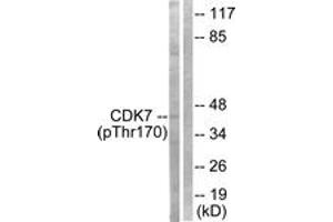 Western blot analysis of extracts from HeLa cells treated with Calyculin A 50nM 30', using CDK7 (Phospho-Thr170) Antibody.