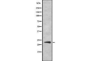 Image no. 3 for anti-Suppressor of Cytokine Signaling 2 (SOCS2) antibody (ABIN6265216)