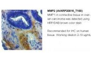 Image no. 1 for anti-Matrix Metalloproteinase 2 (MMP2) (C-Term) antibody (ABIN2792308)