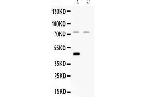 Image no. 1 for anti-Complement Factor I (CFI) (AA 19-220) antibody (ABIN4886537)