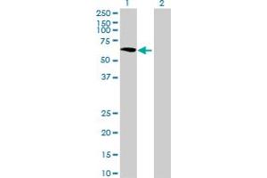 GALNTL1 antibody  (AA 1-558)