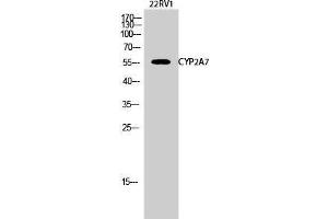 Image no. 2 for anti-Cytochrome P450, Family 2, Subfamily A, Polypeptide 7 (CYP2A7) (C-Term) antibody (ABIN3184174)