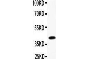 Image no. 1 for anti-NEDD8 Activating Enzyme E1 Subunit 1 (NAE1) (AA 181-534) antibody (ABIN3043281)