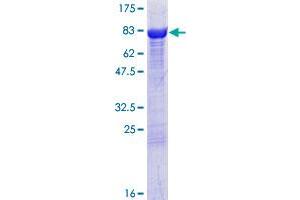 Image no. 1 for Dihydropyrimidinase-Like 4 (DPYSL4) (AA 1-572) protein (GST tag) (ABIN1351994)