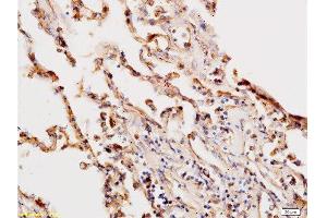 Image no. 3 for anti-HCG beta (AA 81-165) antibody (ABIN730243)