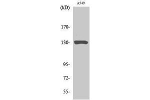Image no. 1 for anti-Janus Kinase 1 (JAK1) (Ser639) antibody (ABIN3185253)