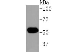 Image no. 1 for anti-Keratin 16 (KRT16) antibody (ABIN5557440)
