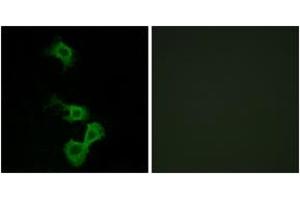 Image no. 2 for anti-Disabled Homolog 1 (Drosophila) (DAB1) (AA 199-248) antibody (ABIN1532844)