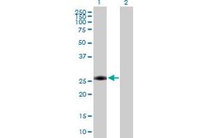 Image no. 2 for anti-Achalasia, Adrenocortical Insufficiency, Alacrimia (AAAS) (AA 1-546) antibody (ABIN521759)