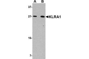 Image no. 2 for anti-Killer Cell Lectin-Like Receptor, Subfamily A, Member 1 (KLRA1) (C-Term) antibody (ABIN783823)