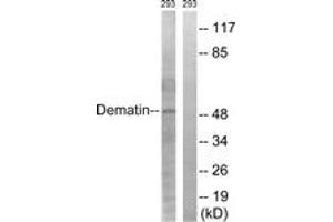 Image no. 1 for anti-erythrocyte Membrane Protein Band 4.9 (Dematin) (EPB49) (AA 356-405) antibody (ABIN1532596)