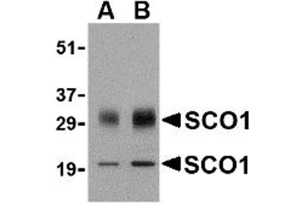 anti-SCO1 Cytochrome C Oxidase Assembly Protein (SCO1) (Middle Region) antibody