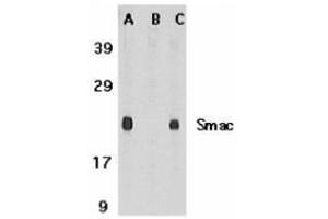 Image no. 2 for anti-Second Mitochondria-Derived Activator of Caspase (DIABLO) (AA 222-237), (C-Term) antibody (ABIN500784)