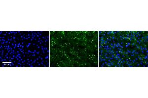 Image no. 1 for anti-AarF Domain Containing Kinase 2 (ADCK2) (Middle Region) antibody (ABIN2789386)