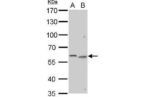 Image no. 4 for anti-Galactosamine (N-Acetyl)-6-Sulfate Sulfatase (GALNS) (Center) antibody (ABIN2856743)