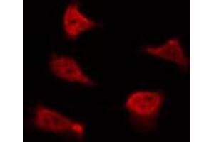 Ezrin anticorps  (pTyr478)