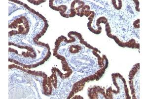 Image no. 4 for anti-Keratin 7 (KRT7) antibody (ABIN6939871)