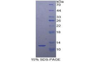 Image no. 1 for Sema Domain, Immunoglobulin Domain (Ig), Short Basic Domain, Secreted, (Semaphorin) 3E (SEMA3E) (AA 651-740) protein (His tag) (ABIN1877955)