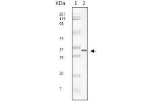 Image no. 1 for anti-SARS-Coronavirus Membrane Protein (SARS-CoV M) antibody (ABIN1724639)