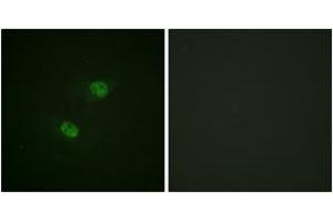 Immunofluorescence analysis of HeLa cells, using CDC16/APC6 (Phospho-Ser560) Antibody.