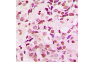 Image no. 1 for anti-serologically Defined Colon Cancer Antigen 1 (SDCCAG1) (C-Term) antibody (ABIN2705030)