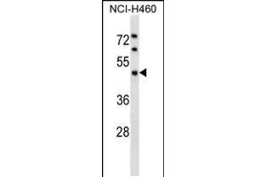 Image no. 1 for anti-Kaptin (Actin Binding Protein) (KPTN) (AA 245-273) antibody (ABIN5536451)