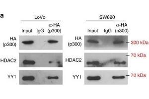 Image no. 17 for anti-Histone Deacetylase 2 (HDAC2) antibody (ABIN3022867)