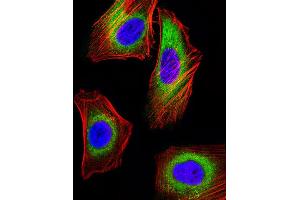 Image no. 6 for anti-MHC Class I Polypeptide-Related Sequence A (MICA) (AA 68-97) antibody (ABIN652566)