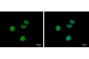 Image no. 1 for anti-Retinoic Acid Receptor, gamma (RARG) (Center) antibody (ABIN2855517)
