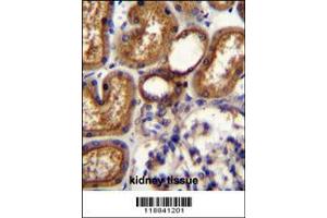 Image no. 1 for anti-Wilms Tumor 1 (WT1) (Center) antibody (ABIN2494167)