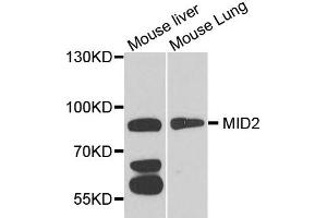 Image no. 1 for anti-Midline 2 (MID2) antibody (ABIN2737170)