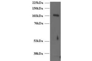 Image no. 2 for anti-Unc-13 Homolog D (UNC13D) (C-Term) antibody (ABIN185243)