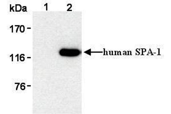 anti-Signal-Induced Proliferation-Associated 1 (SIPA1) antibody
