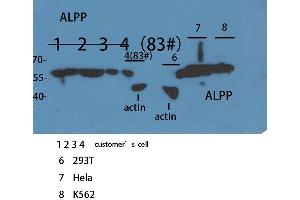 Image no. 2 for anti-Placental Alkaline Phosphatase (ALPP) (N-Term) antibody (ABIN3187883)