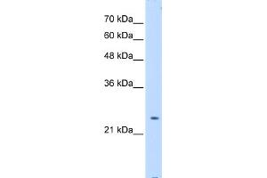 Image no. 1 for anti-Protein tyrosine Phosphatase, Non-Receptor Type 2 (PTPN2) (Middle Region) antibody (ABIN2782195)